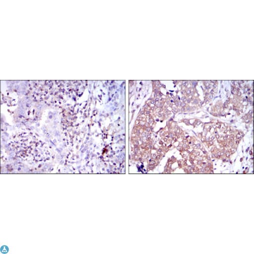 NFKB1 / NF-Kappa-B Antibody