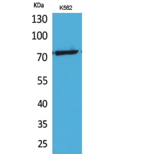 TP73 / p73 Antibody (acetylation site of K321.)