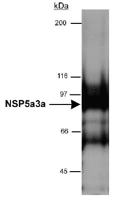 SPECC1 / CYTSB Antibody (aa200-300, DY488)