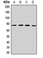 ZNF408 / PRDM17 Antibody