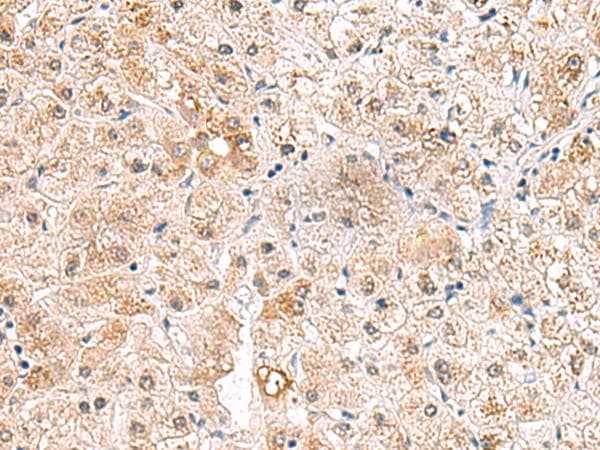 Polyclonal Rabbit anti-Human RTKN2 Antibody (IHC)
