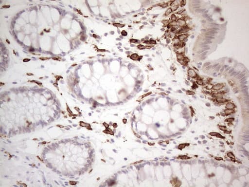 ITGAM / CD11b Antibody (clone OTI12C10)