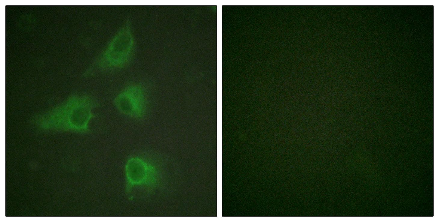 DPYSL2 / CRMP2 Antibody (p514)