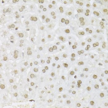 Polyclonal Rabbit anti-Human MAPK3 / ERK1 Antibody (IHC, IF, WB)