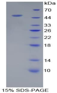 Human PSMC6 Protein (Recombinant His-T7)
