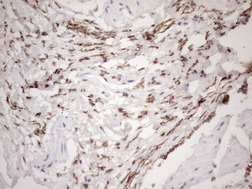 EXOSC1 / CSL4 Antibody (clone OTI4B7)