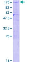 Human USP20 / VDU2 Protein (Recombinant GST)