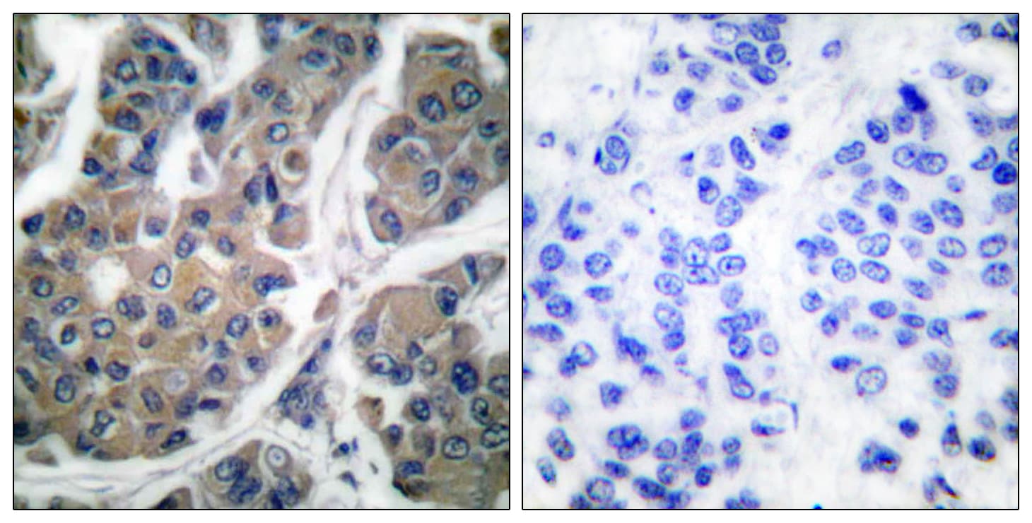 Polyclonal Rabbit anti-Human EEF2 / Elongation Factor 2 Antibody (phospho-Thr56, IHC, IF, WB)