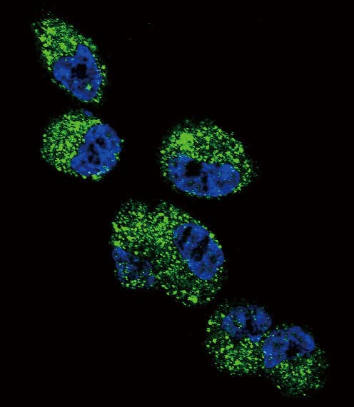 CYP4A11 Antibody (aa407-435)