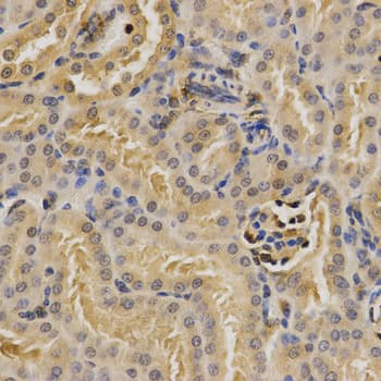 PSMD9 / 26S Proteasome Antibody