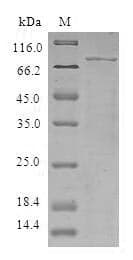 Human TRIM5 Protein (Recombinant 6His, N-terminus)