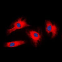Polyclonal Rabbit anti-Human YWHAZ / 14-3-3 Zeta Antibody (Internal, IHC, IF, WB)
