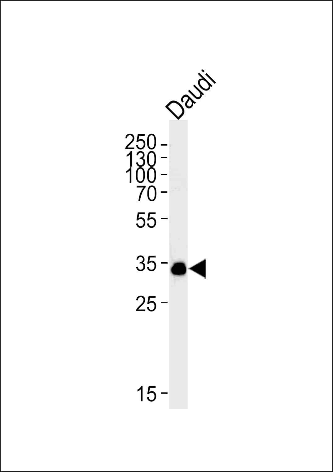 POU2AF1 / BOB1 Antibody (clone 1170CT1.1.1)