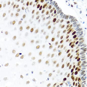 Polyclonal Rabbit anti-Human KHDRBS2 / SLM-1 Antibody (IHC, WB)