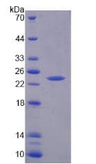 Human TNNI1 Protein (Recombinant His)