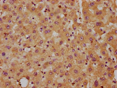 Delta3 / DLL3 Antibody (aa27-492)