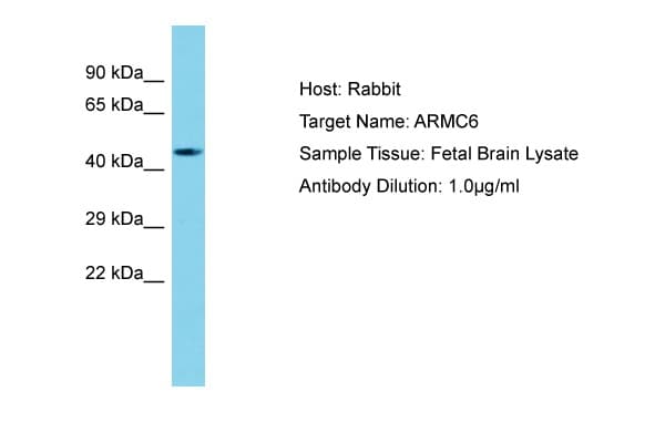 Polyclonal Rabbit anti-Human ARMC6 Antibody (aa157-206, WB)