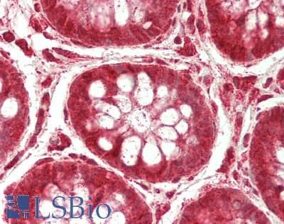 IHC-plus™ Polyclonal Rabbit anti-Human IDN3 / NIPBL Antibody (aa550-600, IHC)