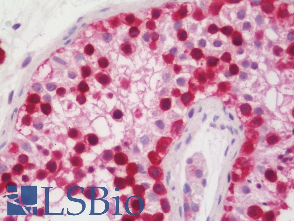 IHC-plus™ GAGE7 Antibody (aa87-116)
