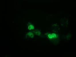 EPM2AIP1 Antibody (clone OTI1F11)