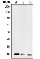 RPL28 / Ribosomal Protein L28 Antibody (Internal)