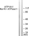 ATP1A1 Antibody (aa15-64)