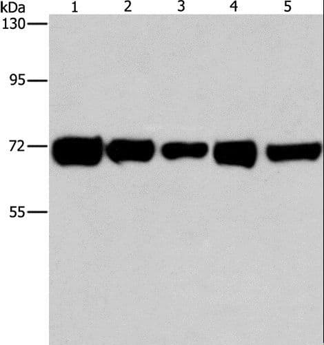RPN1 / Ribophorin I Antibody