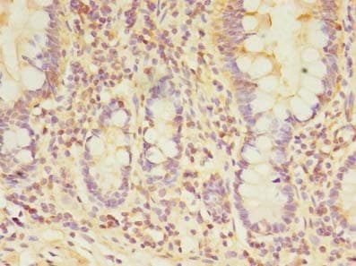Polyclonal Rabbit anti-Human TARS2 / TARSL1 Antibody (IHC)