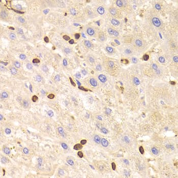 Polyclonal Rabbit anti-Human LSP1 Antibody (IHC, WB)