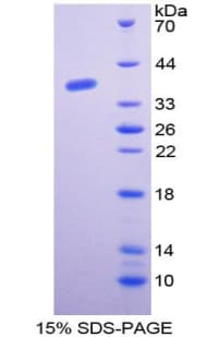 Human GTF2E1 Protein (Recombinant His-T7)