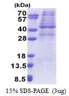 Human PRKAG1 / AMPK Gamma 1 Protein (Recombinant His)