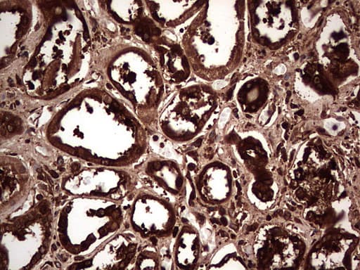 PKM2 Antibody (clone 1G10)