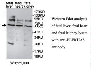 IHC-plus™ Polyclonal Rabbit anti-Human PLEKHA8 Antibody (aa122-400, IHC, WB)