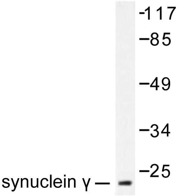Polyclonal Rabbit anti-Human SNCG / Gamma-Synuclein Antibody (Ala111, IHC, WB)