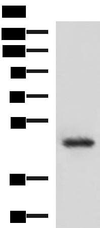 Polyclonal Rabbit anti-Human LDB1 / CLIM2 Antibody (IHC, WB)