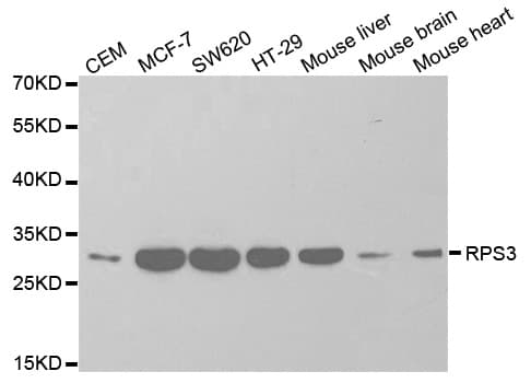 Polyclonal Rabbit anti-Human RPS3 / Ribosomal Protein S3 Antibody (IHC, IF, WB)