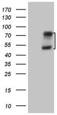ACVR2 / ACVR2A Antibody (aa214-513, clone OTI5D1)
