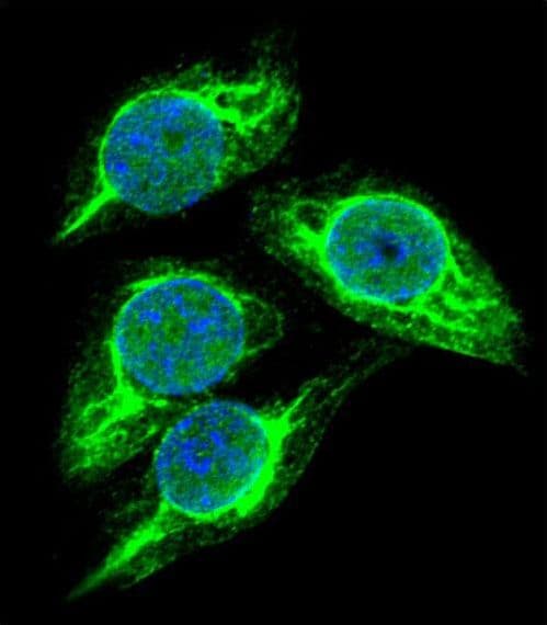 STRA8 Antibody (aa286-315)