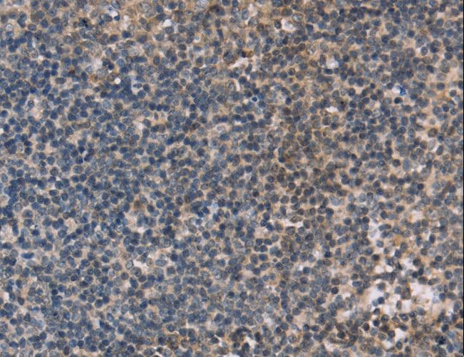 OTC Antibody