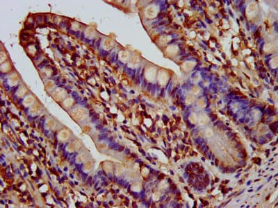 Polyclonal Rabbit anti-Human AQP10 / Aquaporin 10 Antibody (IF)