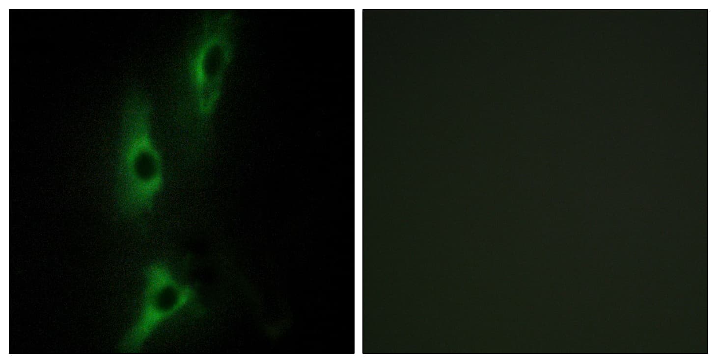 ADRB2 Antibody (aa201-250)