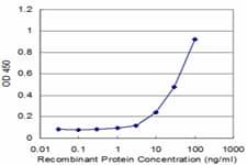 PLS1 / Fimbrin Antibody (clone 3G10)