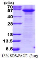 Human CFLAR / FLIP Protein (Recombinant)