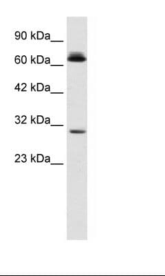 SIRT3 / Sirtuin 3 Antibody (C-Terminus)