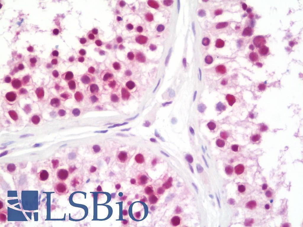 IHC-plus™ Polyclonal Rabbit anti-Human CPSF3 / CPSF Antibody (aa634-684, IHC)