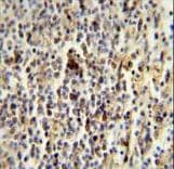 CD1E Antibody (aa184-212)