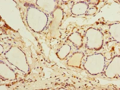 Polyclonal Rabbit anti-Human DDX50 Antibody (IHC, WB)