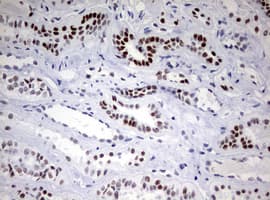 CD5 Antibody (clone OTI10F4)