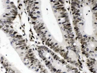 CIITA Antibody