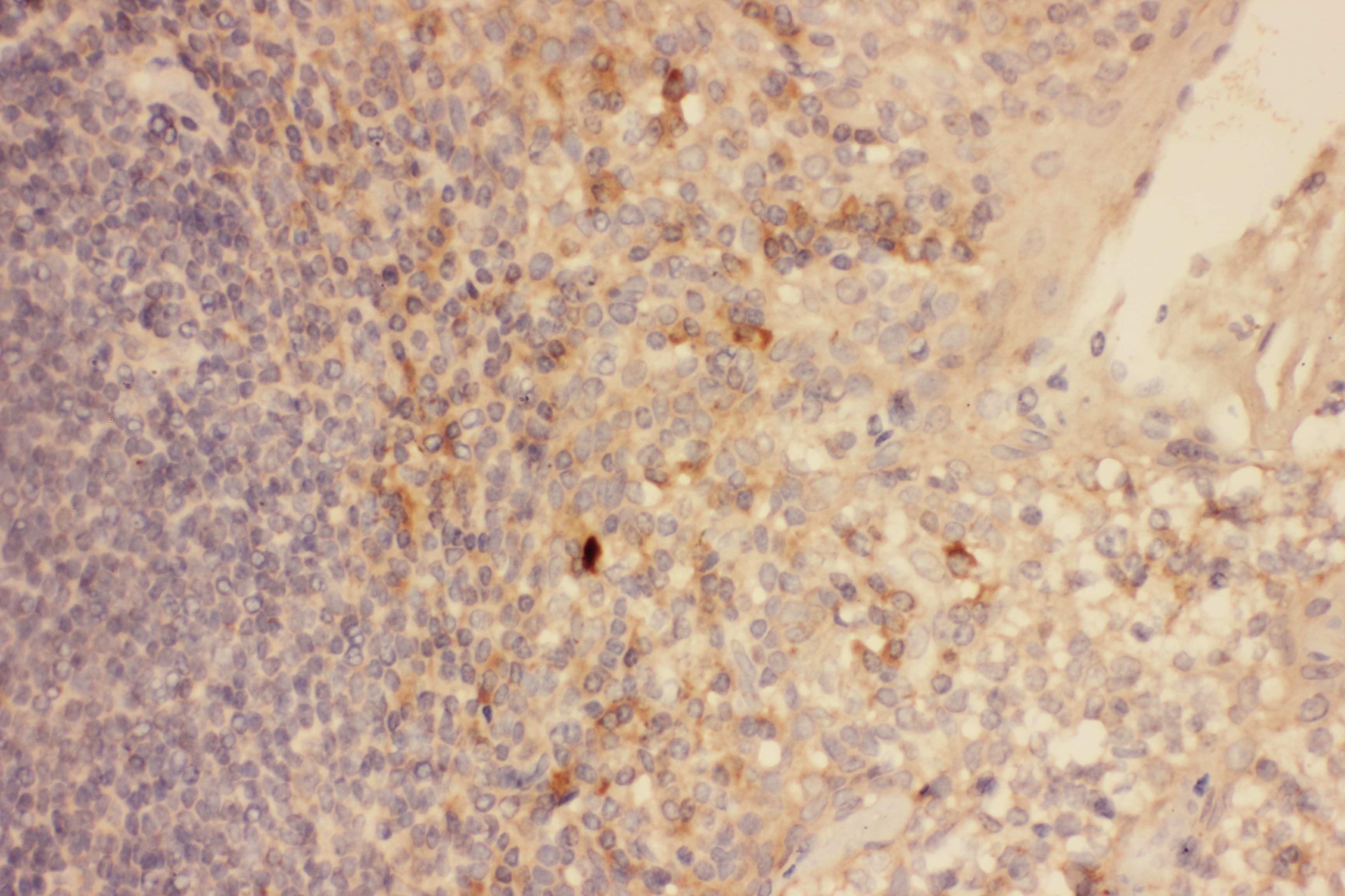CXCR3 Antibody (aa1-368)